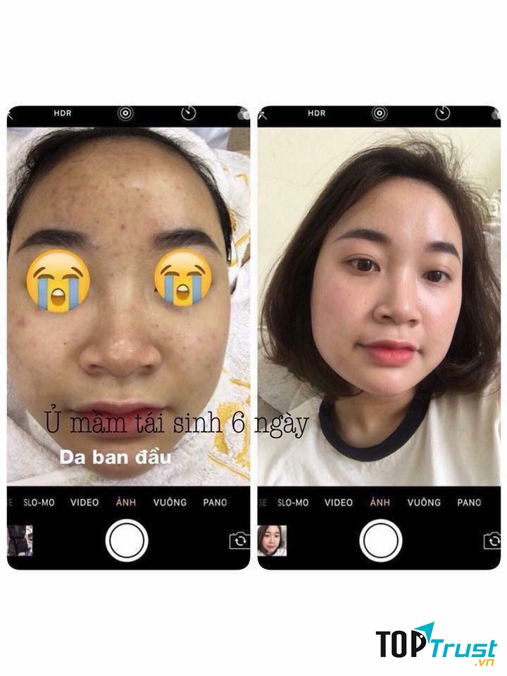 Ngọc anh spa