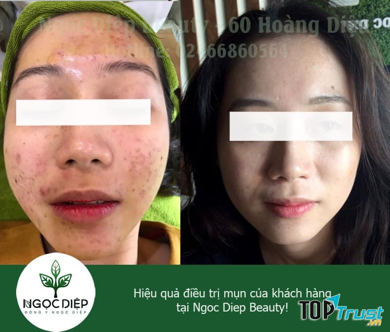 Ngọc Diệp Beauty