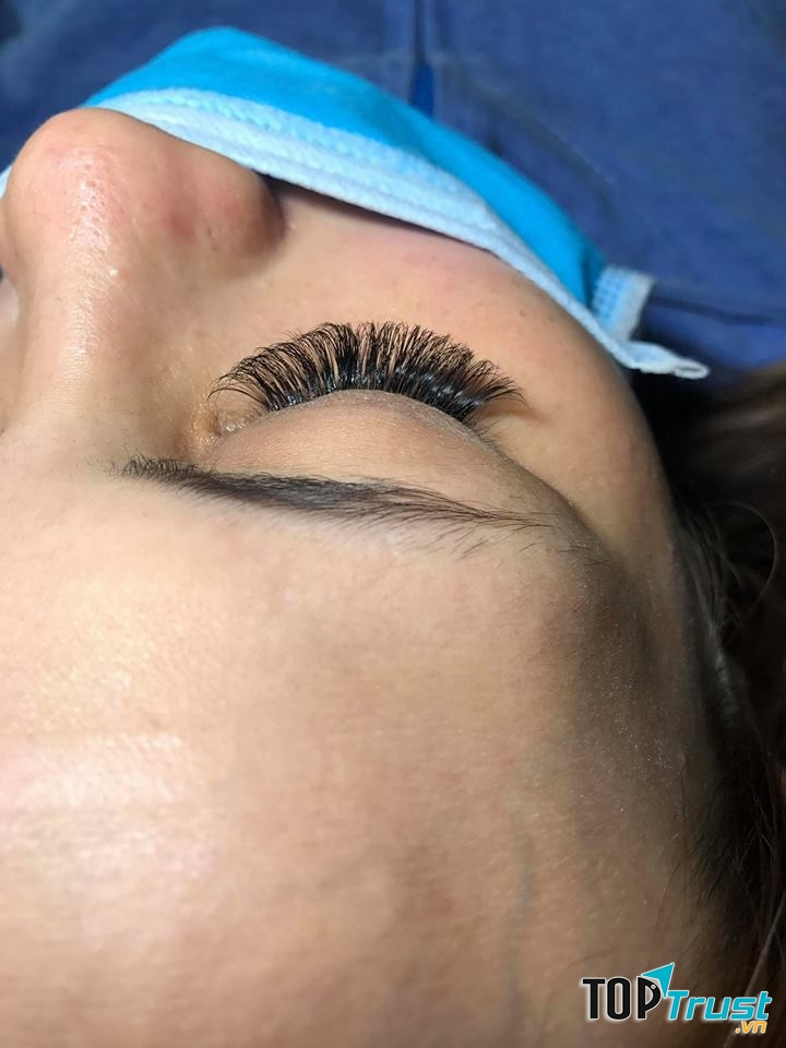 Ngọc Linh Nối Mi