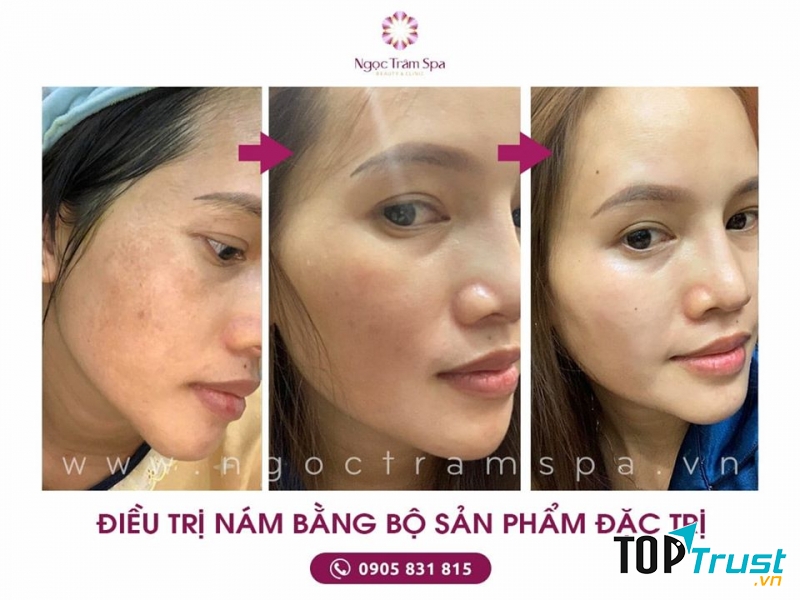 Ngọc Trâm Spa