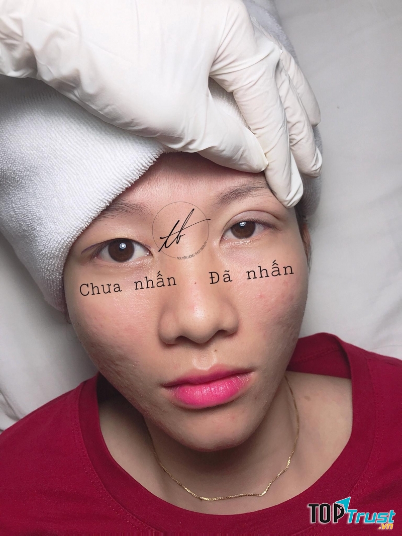 Nguyễn Hồng Thúy nhấn mí