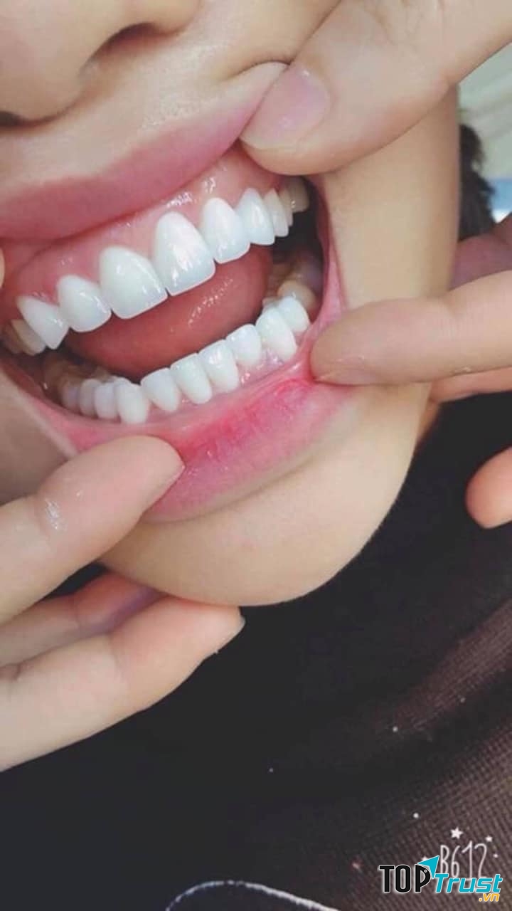 Nha Khoa 2-4 Nha Trang