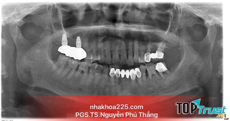 Trung Tâm Nha Khoa 225