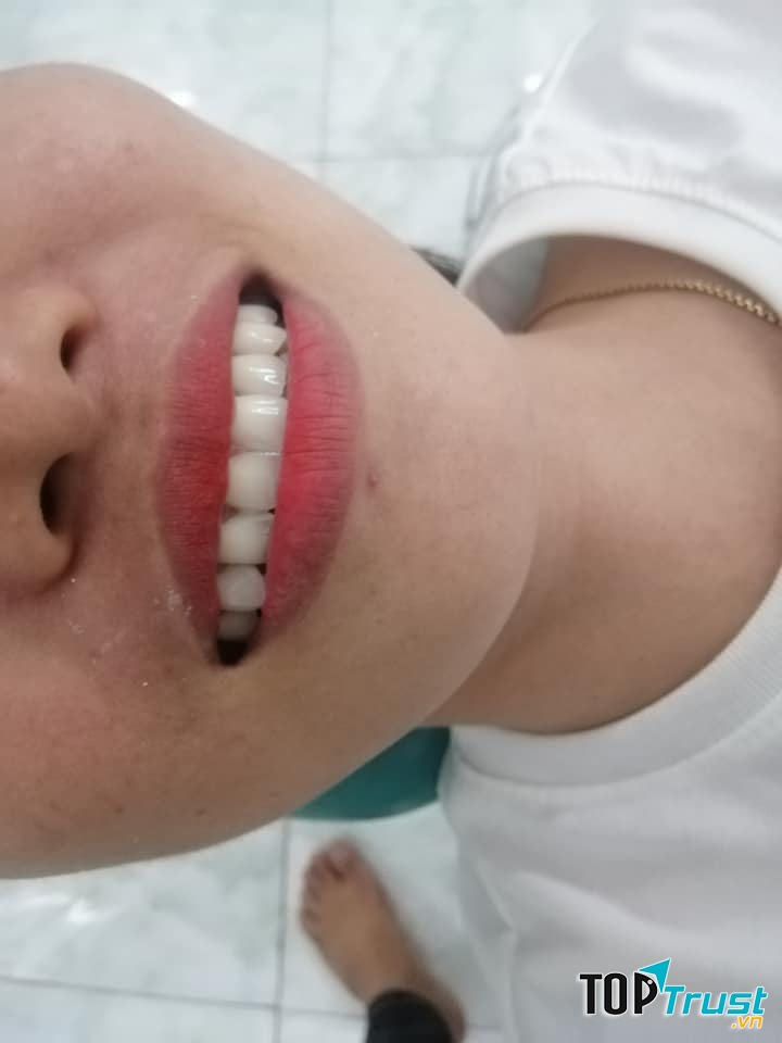 Nha Khoa Á Châu