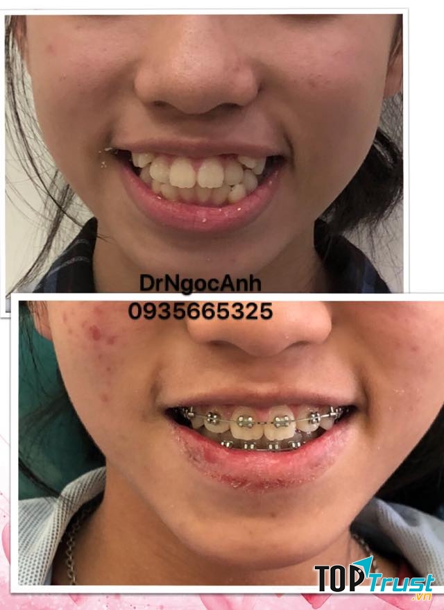 Nha Khoa Anh Dũng - Nha Khoa uy tín tại Pleiku - Gia Lai