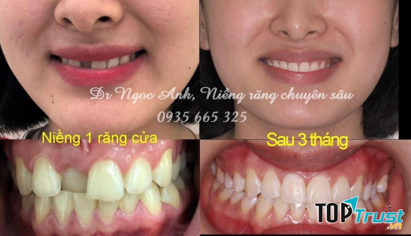 Nha Khoa Anh Dũng - Nha Khoa uy tín tại Pleiku - Gia Lai