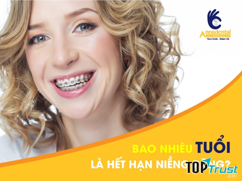 Nha Khoa Anna, niềng răng không bao giờ là muộn