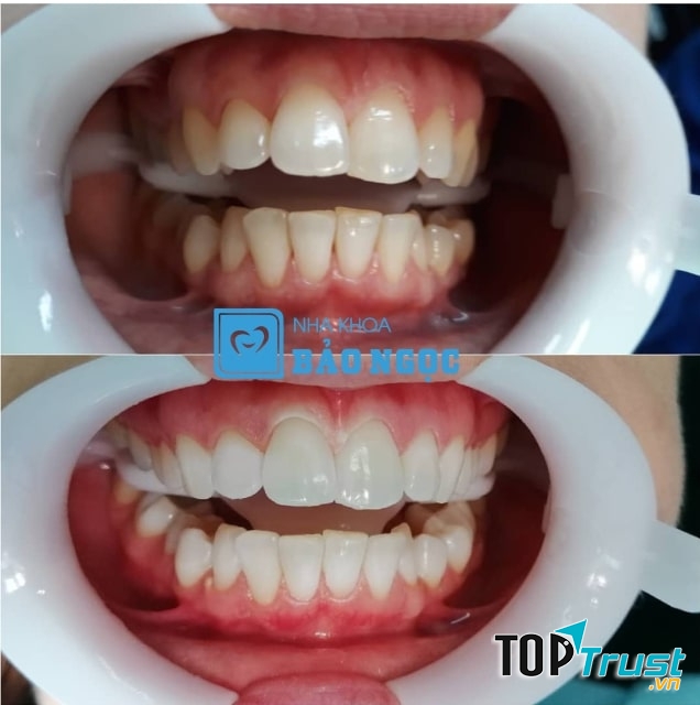 Nha khoa Bảo Ngọc