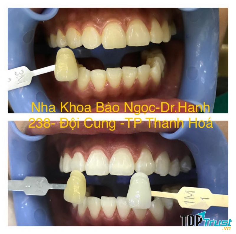 Nha Khoa Bảo Ngọc - Dr.hanh