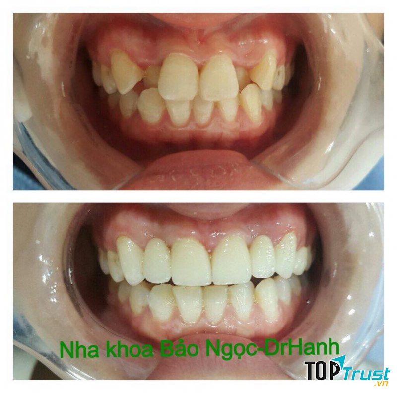Nha Khoa Bảo Ngọc - Dr.hanh