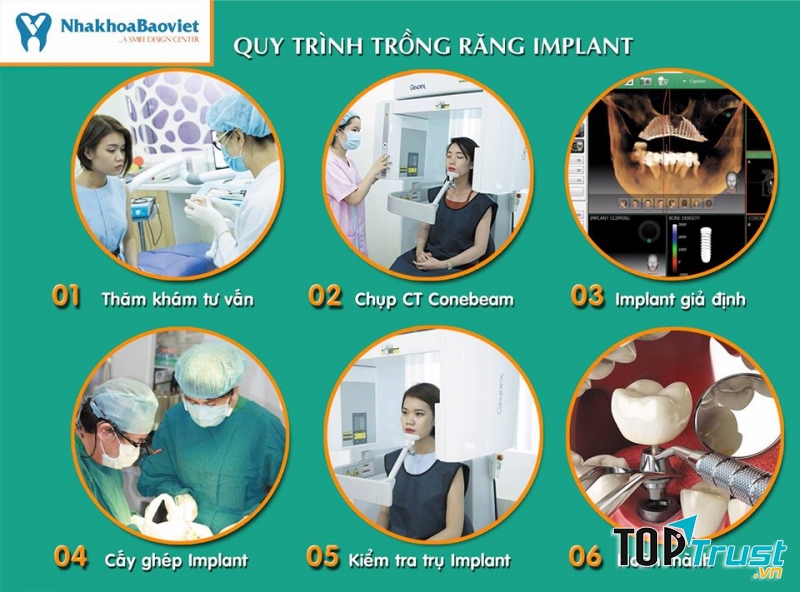 Nha Khoa Bảo Việt