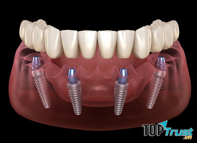 Nha khoa Bảo Việt