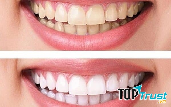 Nha khoa Quốc tế Lamina