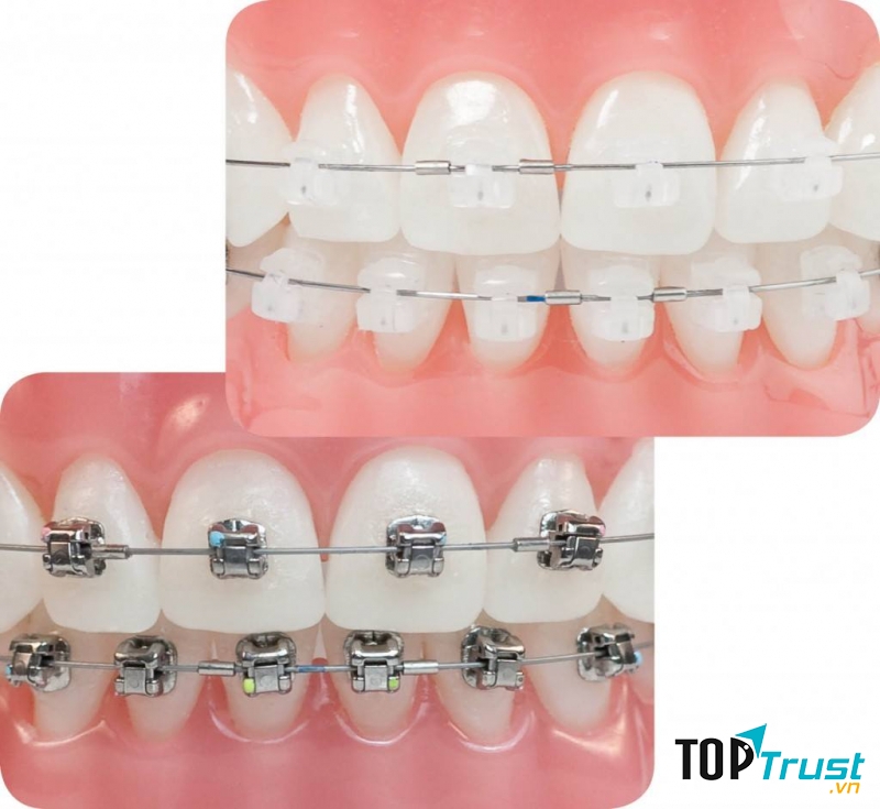 Nha khoa Châu Thành