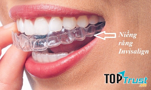 Nha khoa Châu Thành