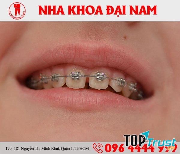 Nha Khoa Đại Nam