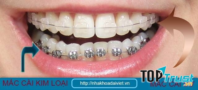 Nha Khoa Đại Việt