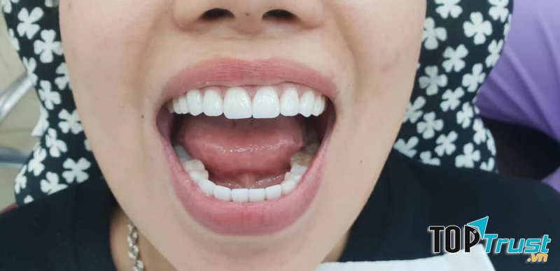 Nha khoa Đăng Khoa