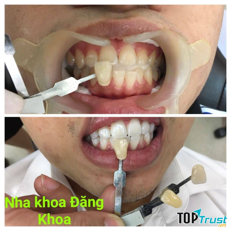 Nha khoa Đăng Khoa