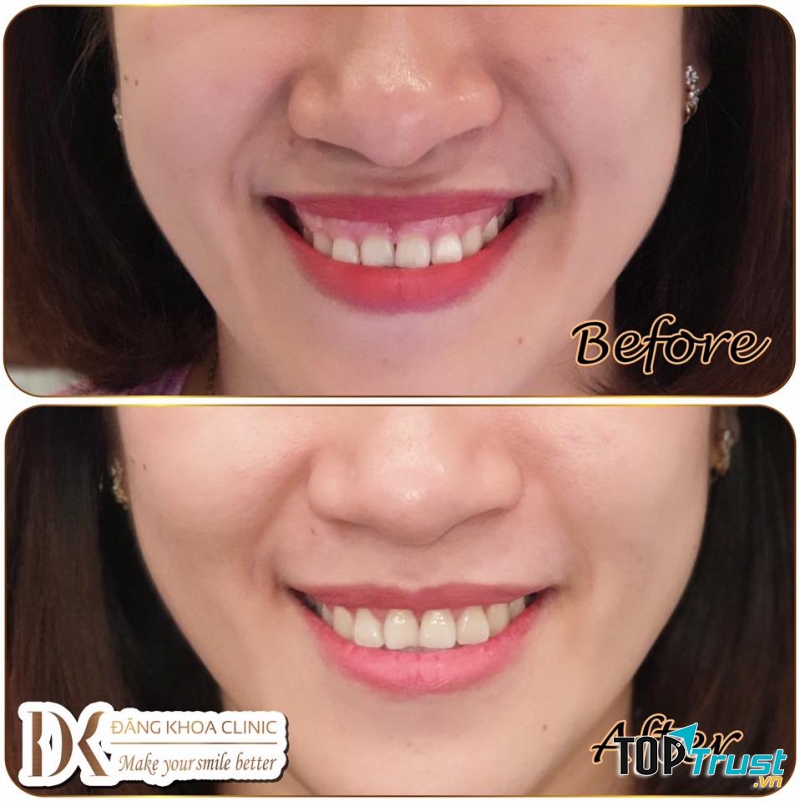 Nha khoa Đăng Khoa