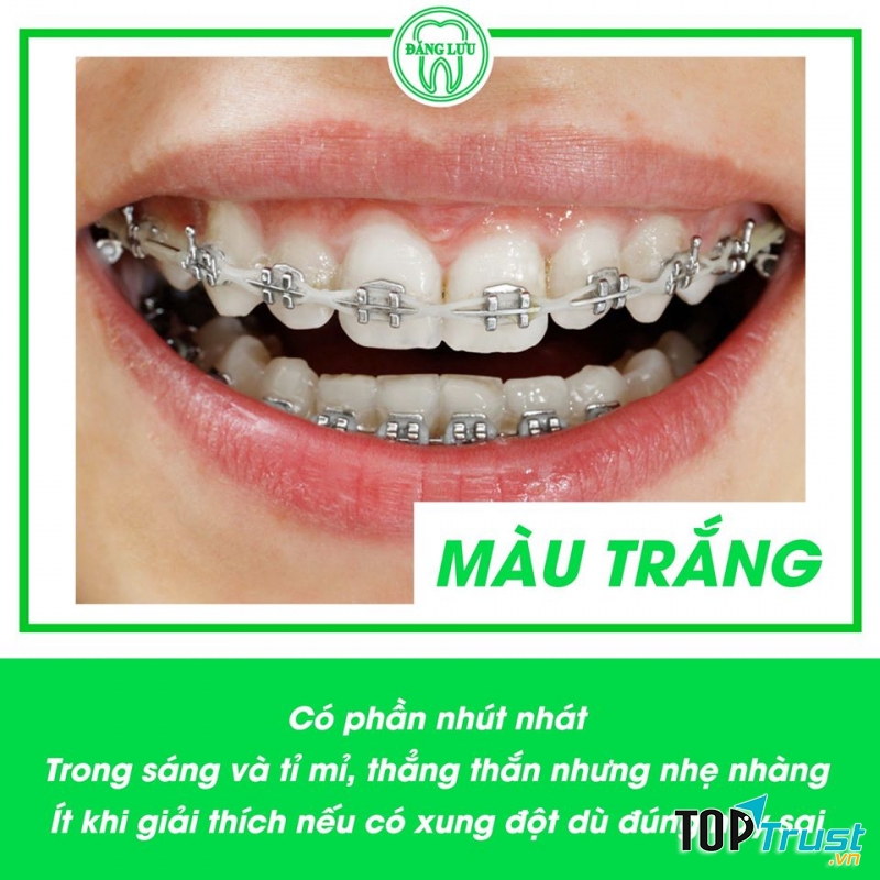 Niềng răng tại Nha khoa Đăng Lưu