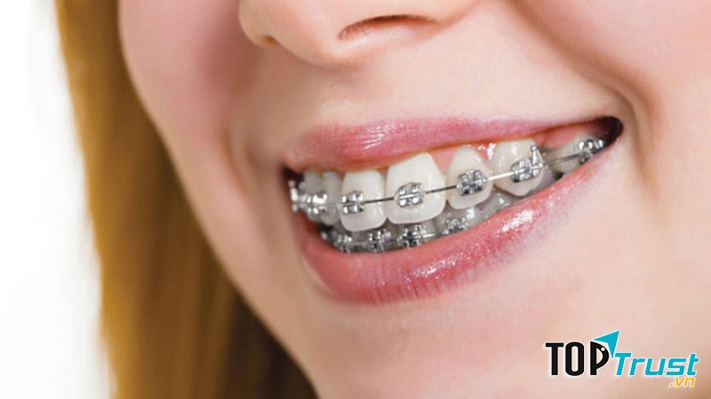 Ảnh minh họa - Nguồn Internet