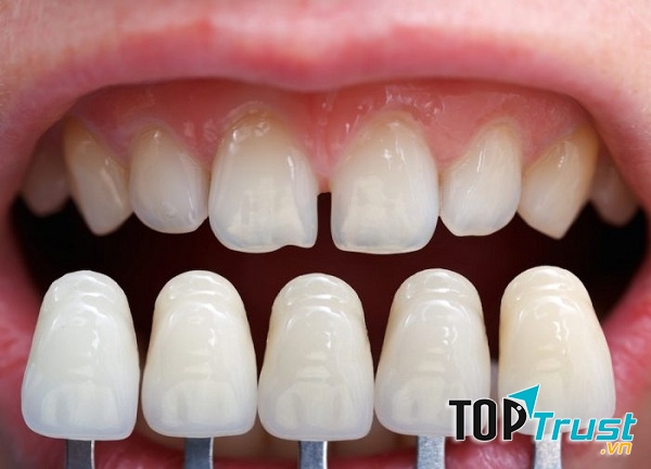 Nha Khoa Dr. Xuân Thủy