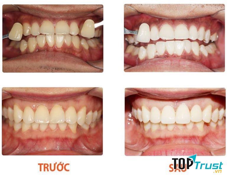 NHA KHOA DR.XUAN THUY