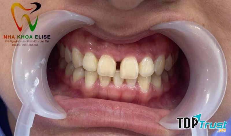Nha khoa Elise