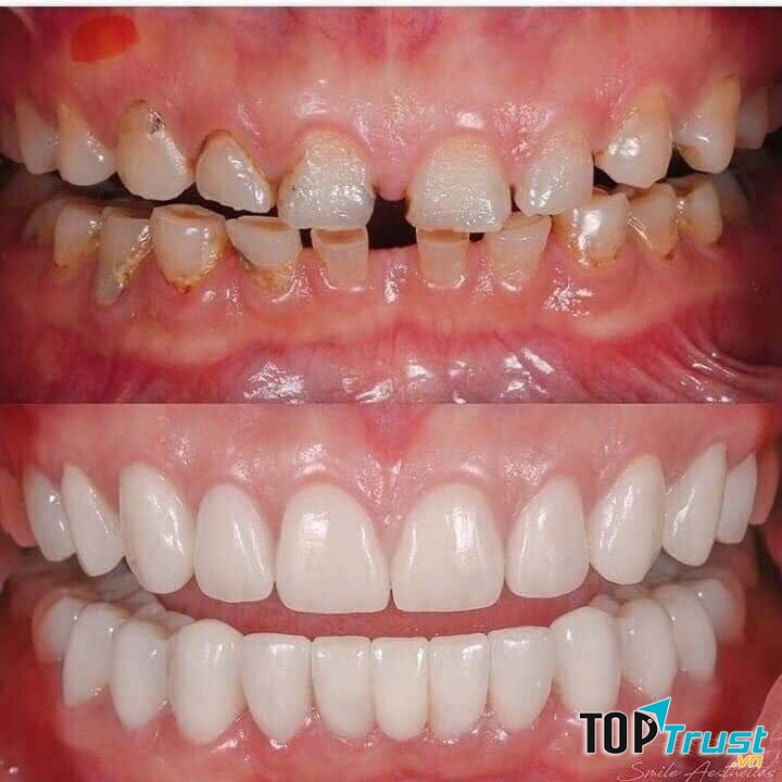 Nha Khoa Garden Smile