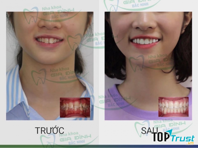 Nha Khoa Gia Đình Bắc Ninh