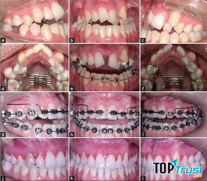 Nha khoa Hà Đương