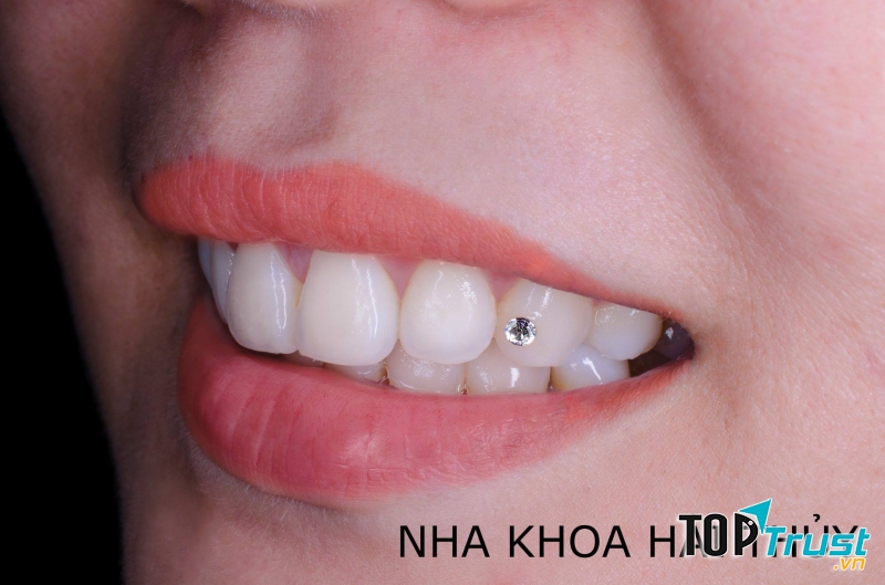 Nha Khoa HẢI THỦY