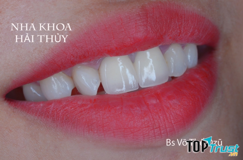 Nha Khoa HẢI THỦY