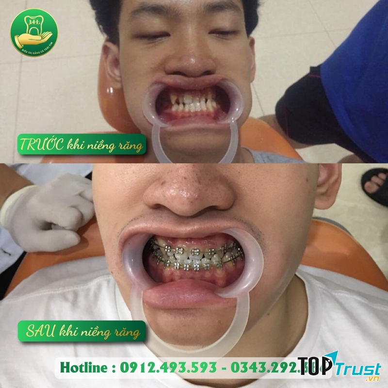 Nha Khoa Hàn Lâm Thái Nguyên