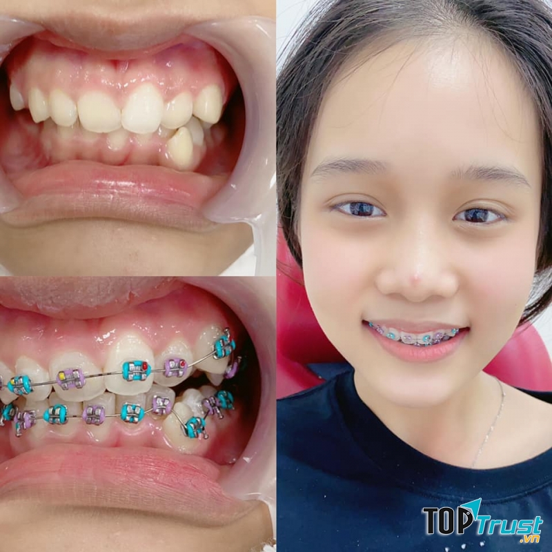 Nha Khoa Happy - Tam Kỳ