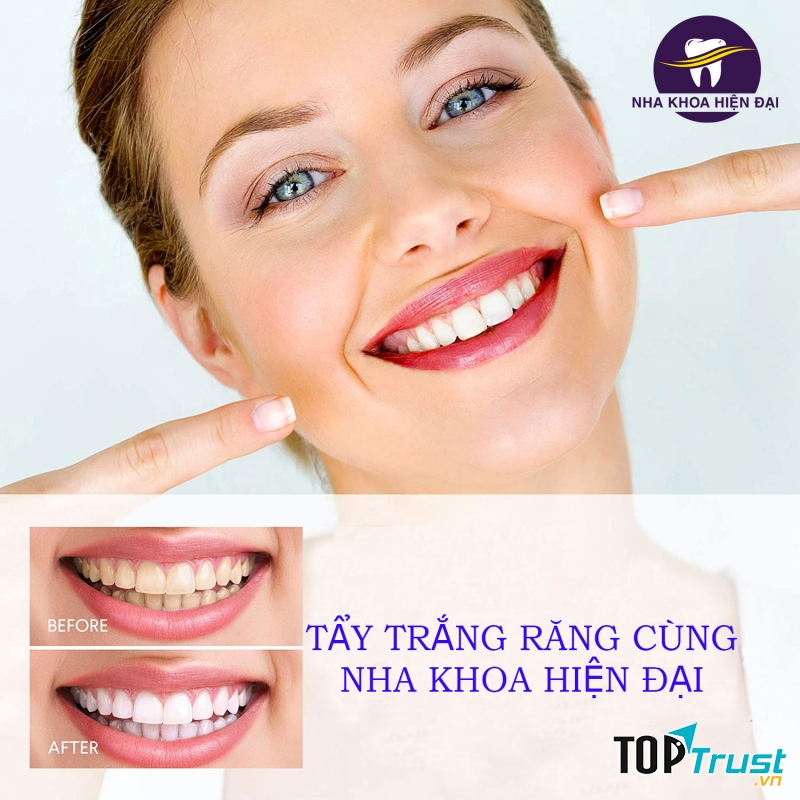 Nha Khoa Hiện Đại