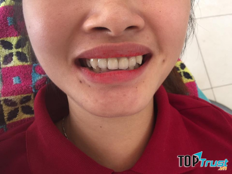 Nha Khoa Hoàn Mỹ 790