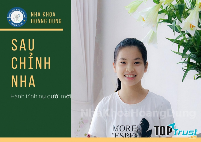 Nha Khoa Hoàng Dung Bắc Ninh.