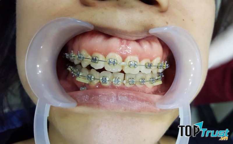 Nha Khoa Hợp Nhất