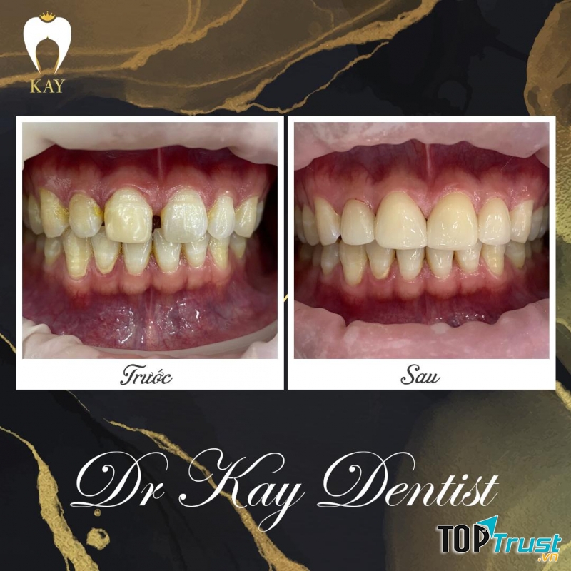 Nha khoa KAY