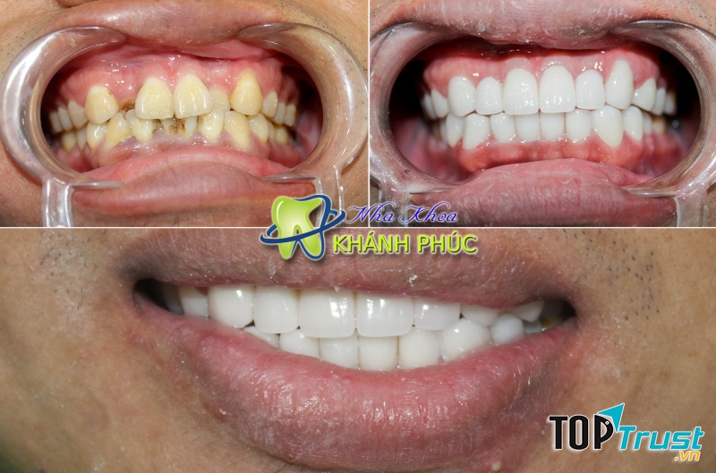 Nha Khoa Khánh Phúc