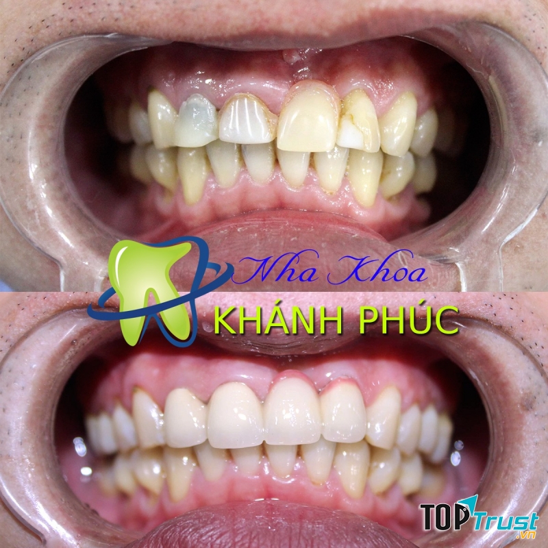 Nha Khoa Khánh Phúc