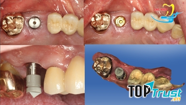 Nha Khoa Lạc Việt Intech