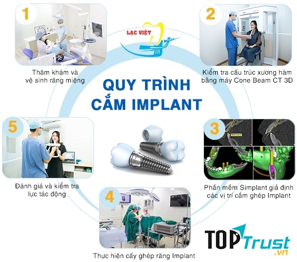 Nha Khoa Lạc Việt Intech