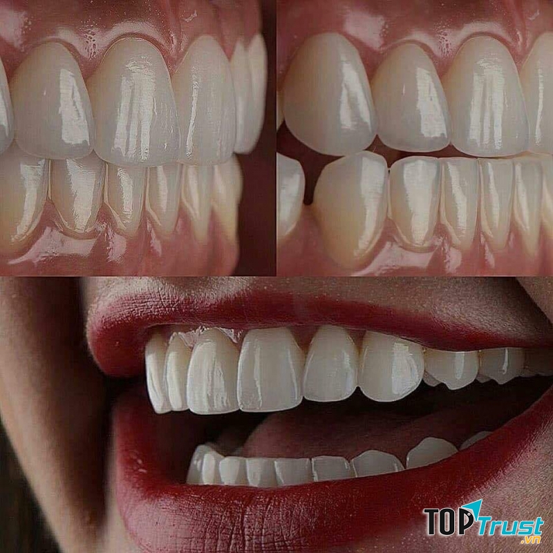 Răng đẹp hơn khi đến với Nha khoa Lê Gia