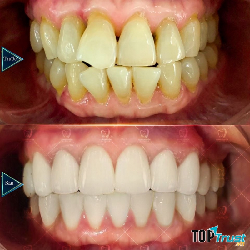 Nha Khoa Long Xuyên