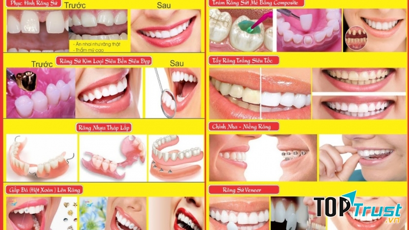 Nha Khoa Minh Đức Sài Gòn, địa chỉ vàng cho hàm răng đẹp