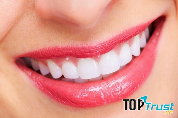 Hình ảnh minh họa