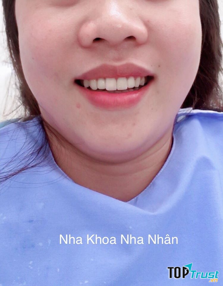 Nha Khoa Nha Nhân